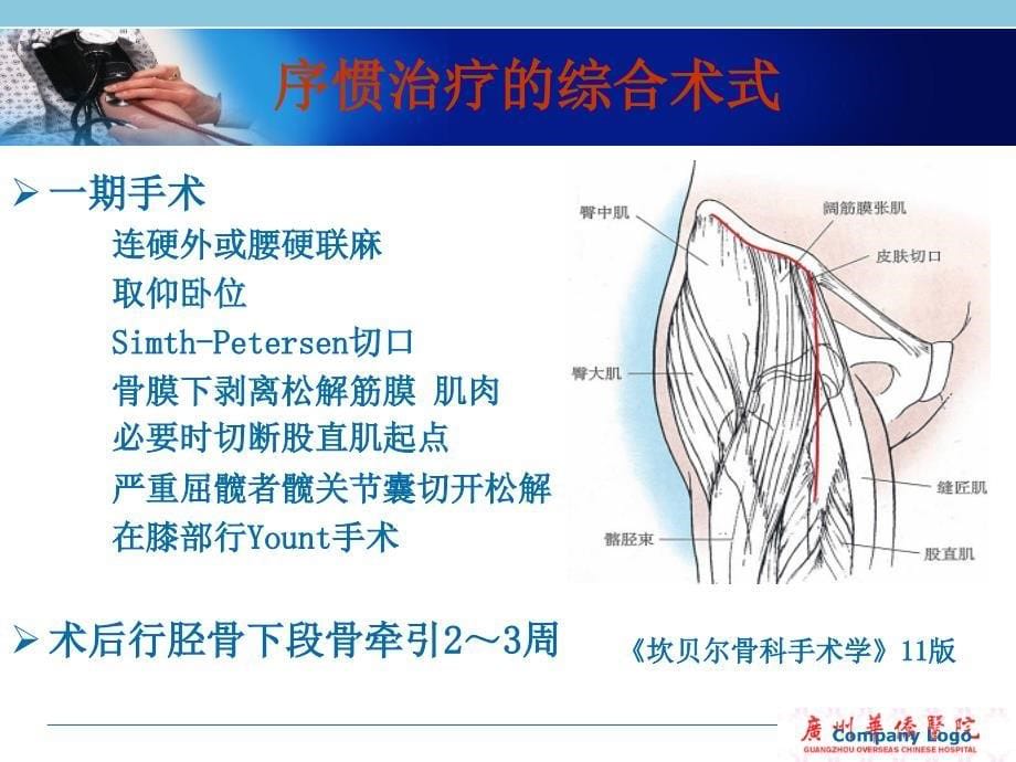 膝关节重度屈曲畸形手术治疗策略.ppt_第5页