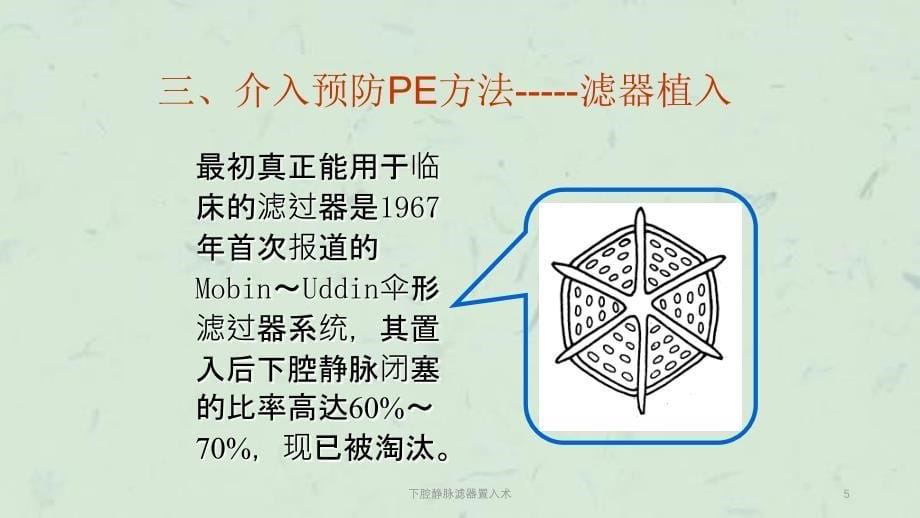 下腔静脉滤器置入术课件_第5页