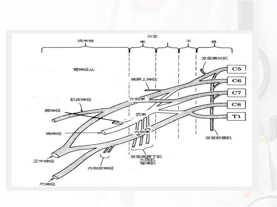 臂丛神经阻滞麻醉ppt课件_第5页