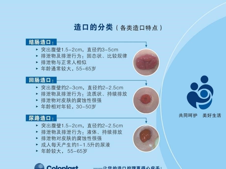 肠造口并发症及护理ppt课件_第5页