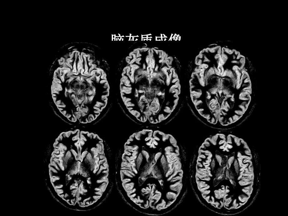 CTMR在儿科的应用课件_第5页