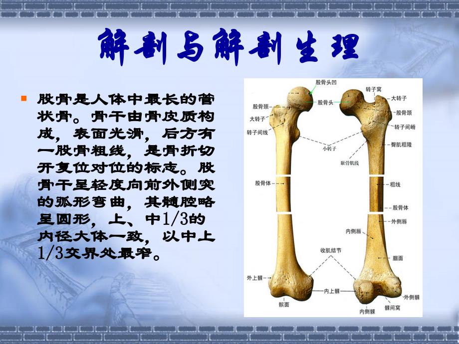 股骨干骨折课件_第3页