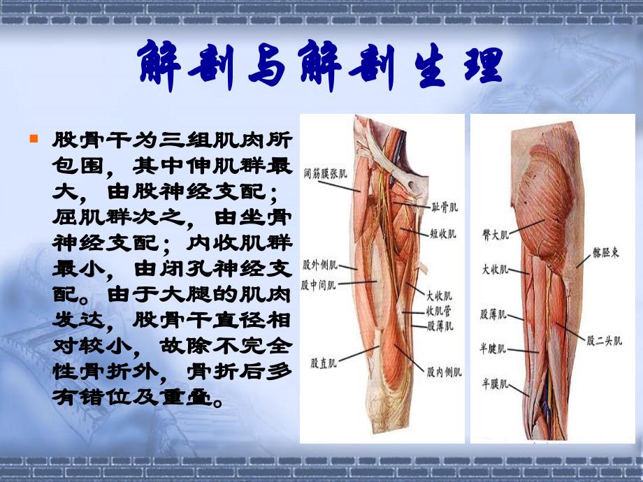 股骨干骨折课件_第4页