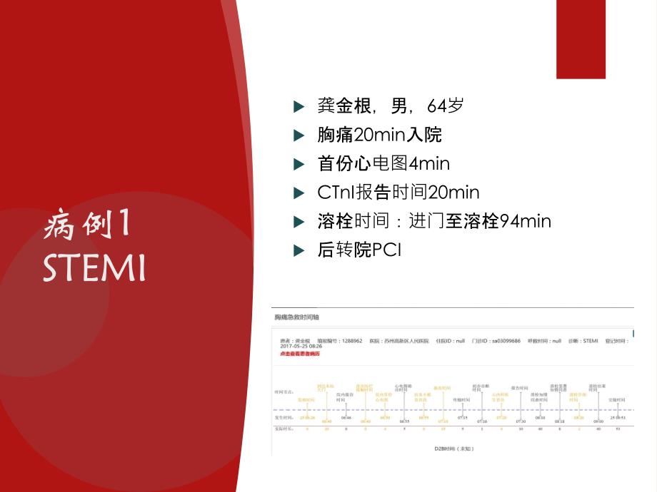 胸痛中心质量分析_第2页