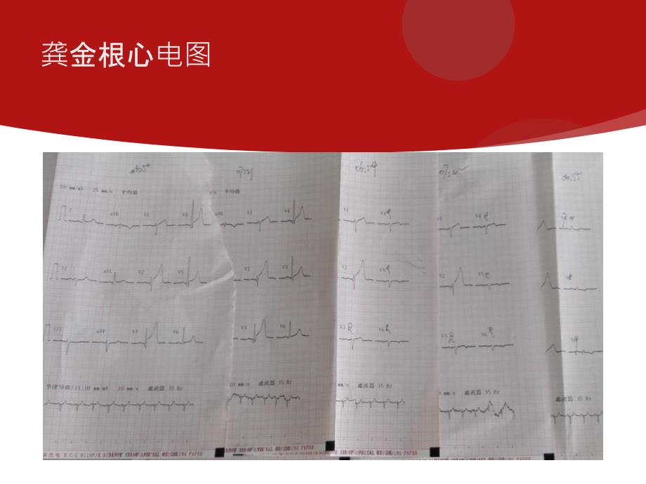 胸痛中心质量分析_第3页