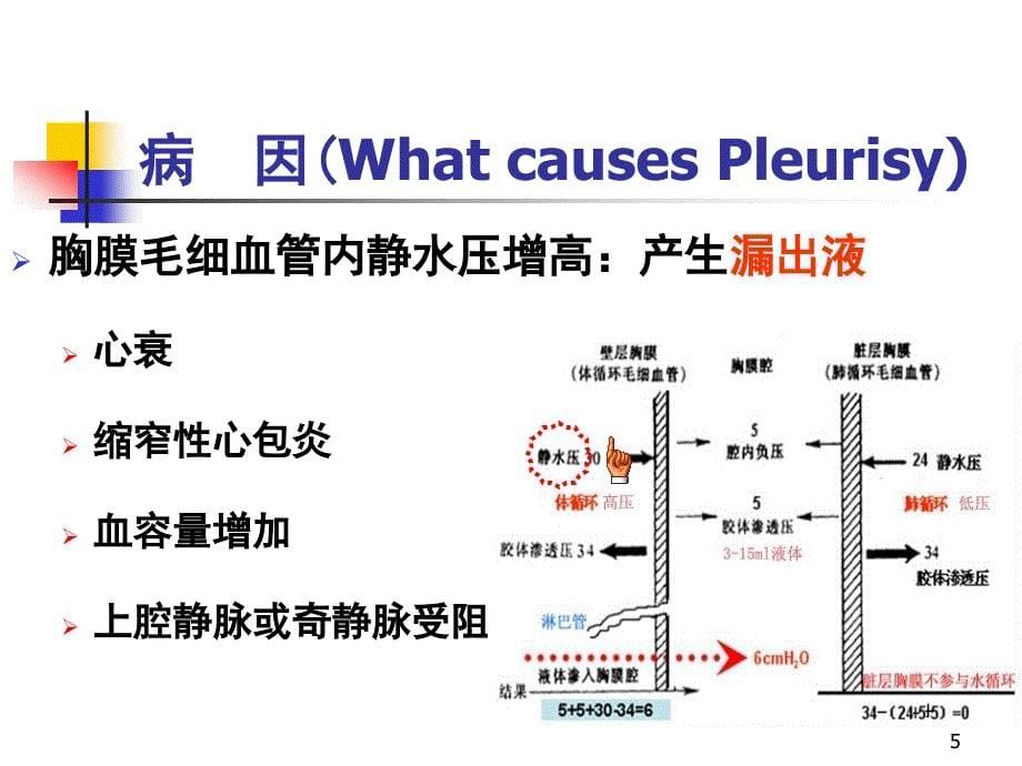 胸腔积液ppt课件_第5页