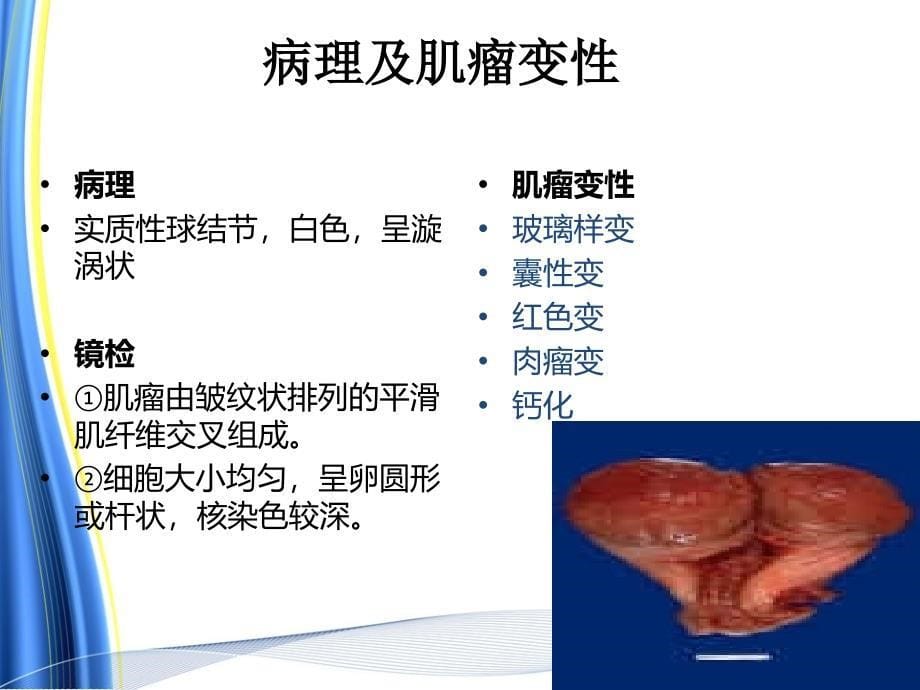 子宫肌瘤病人术后的护理课件PPT3_第5页