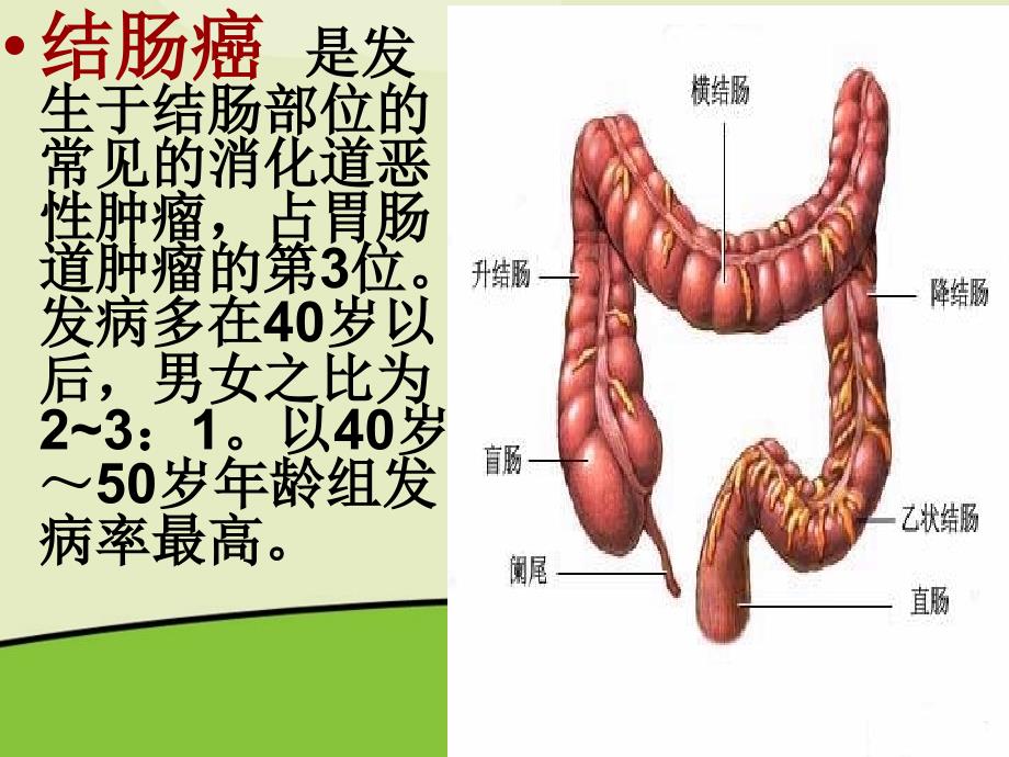 fht乙状结肠癌护理查房PPT优秀课件_第4页