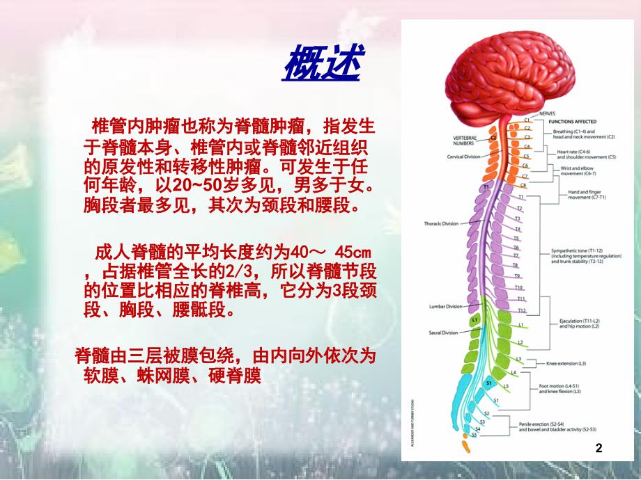 椎管内脊膜瘤的围手术期护理课堂PPT_第2页