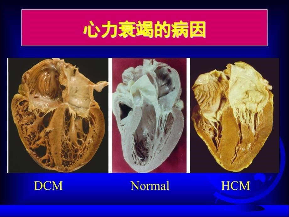 内科学课件：心力衰竭_第5页