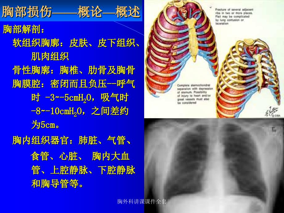 最新胸外科讲课课件全套_第4页