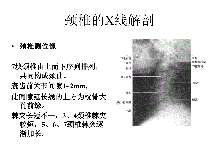 脊柱的X线解剖精_第4页