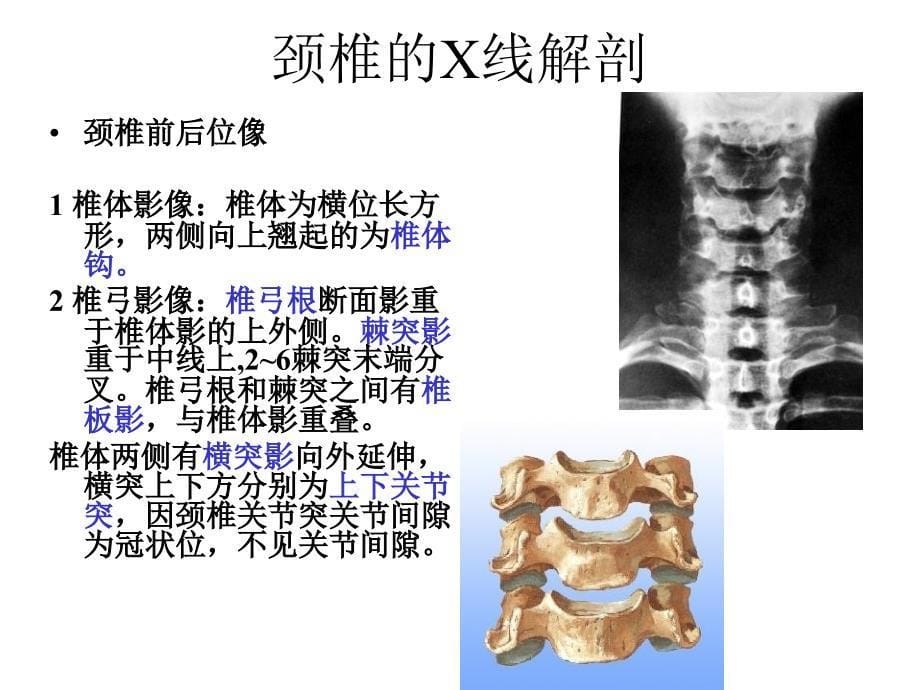 脊柱的X线解剖精_第5页