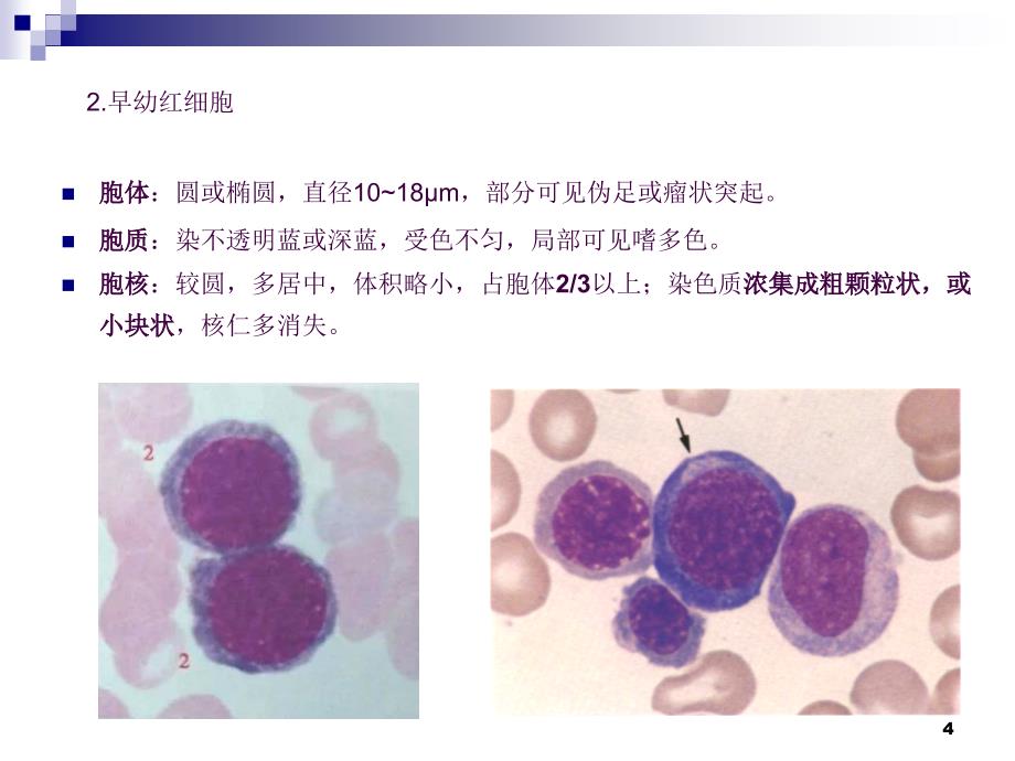 骨髓血细胞形态ppt课件_第4页