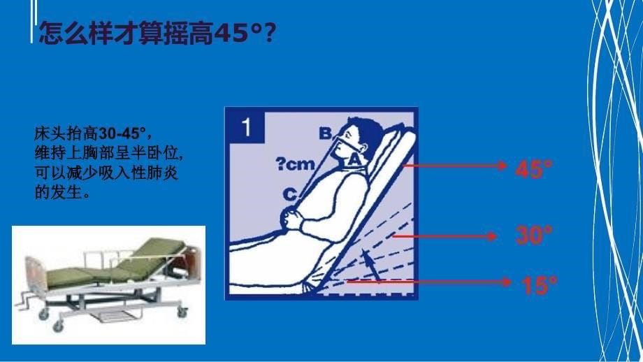 《鼻饲患者的护理》PPT课件_第5页