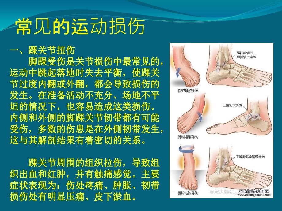 hw----常见损伤的应急处理与急救ppt分析_第2页