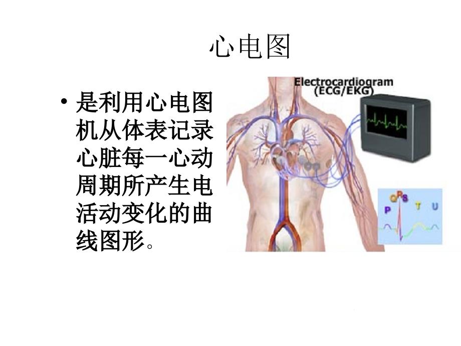 临床心电图 ppt课件_第3页