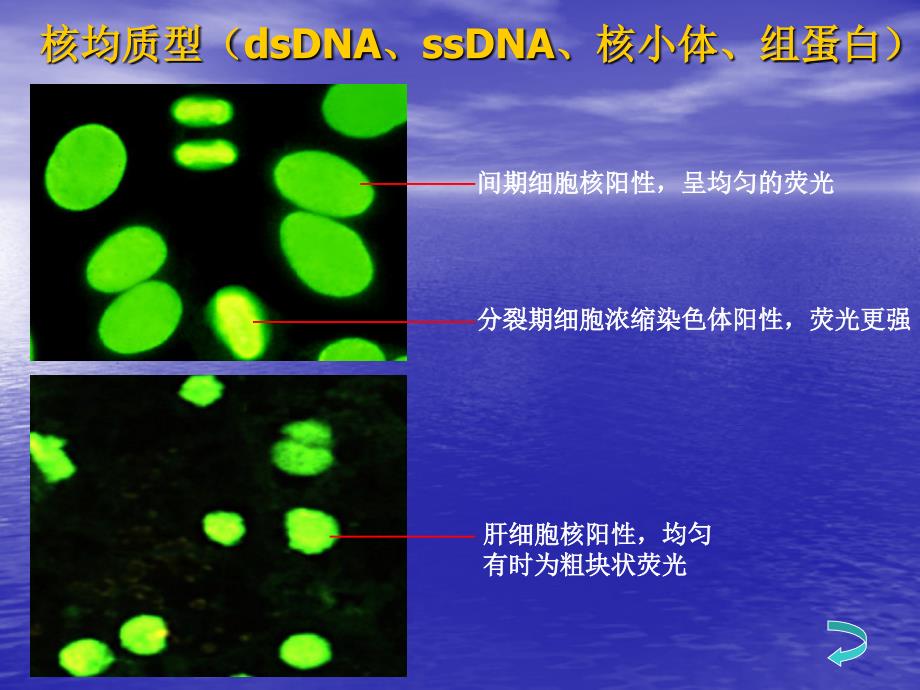 抗核抗体荧光片判读课件.ppt_第3页