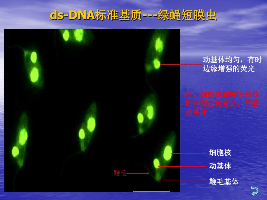 抗核抗体荧光片判读课件.ppt_第4页