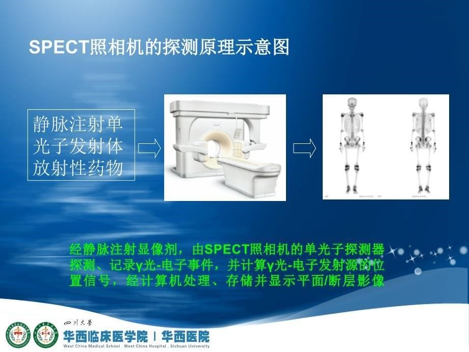 mTP全身骨显像骨显像核医学四川大学.ppt_第5页