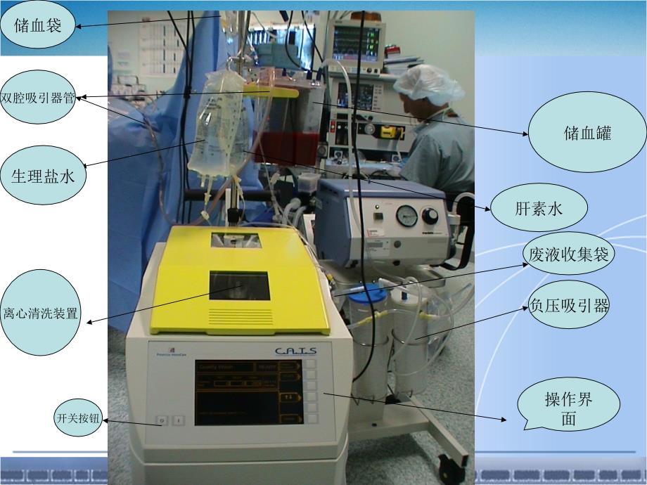 费森尤斯自体血回收机的使用及注意事项_第2页