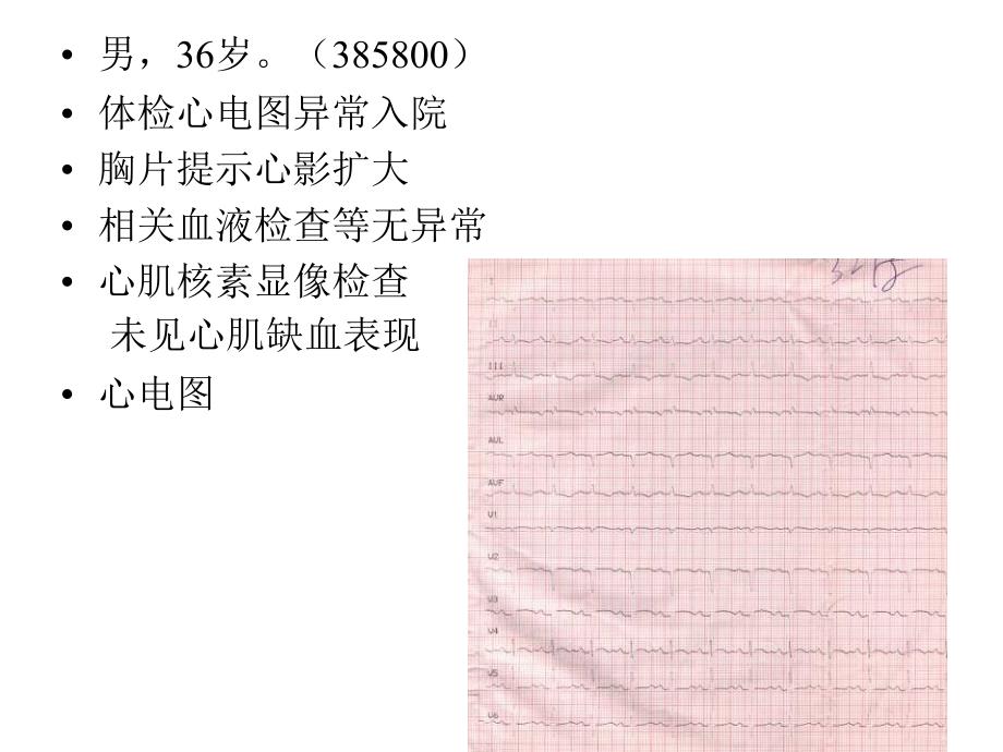 房间隔缺损合并心肌病的治疗_第2页