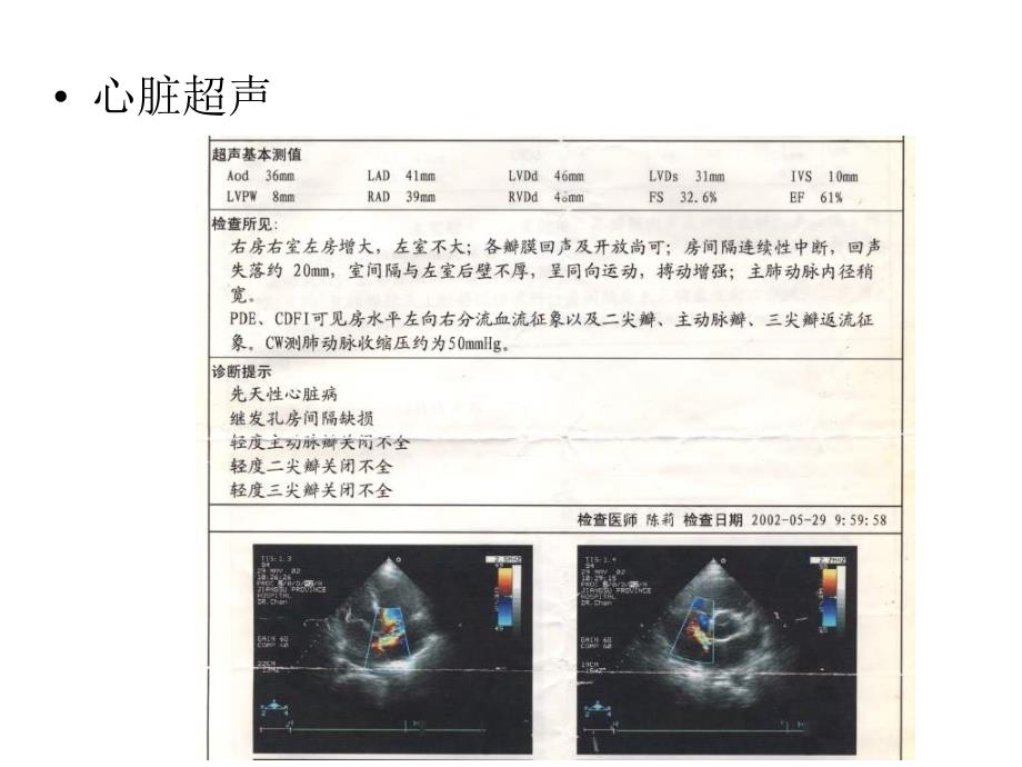 房间隔缺损合并心肌病的治疗_第3页