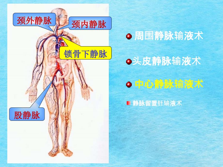 静脉输液2ppt课件_第2页