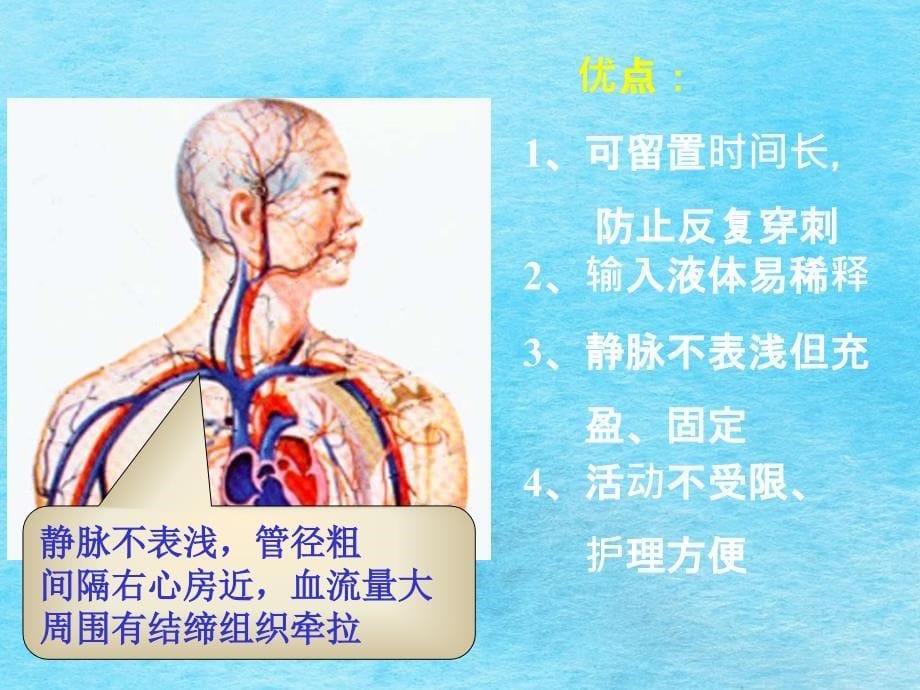 静脉输液2ppt课件_第5页