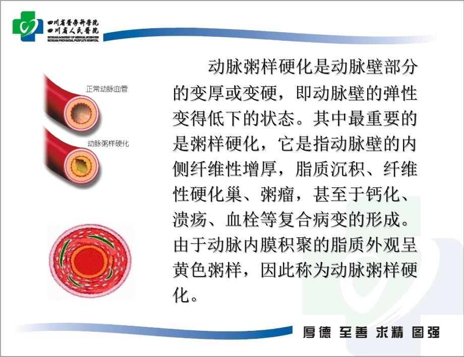 《动脉硬化检测》PPT课件_第4页