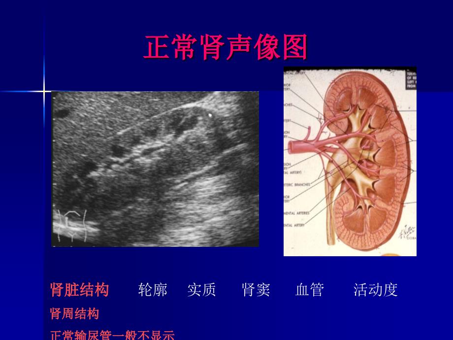 泌尿系疾病超声诊上海交通大学附属第六人民医院_第4页