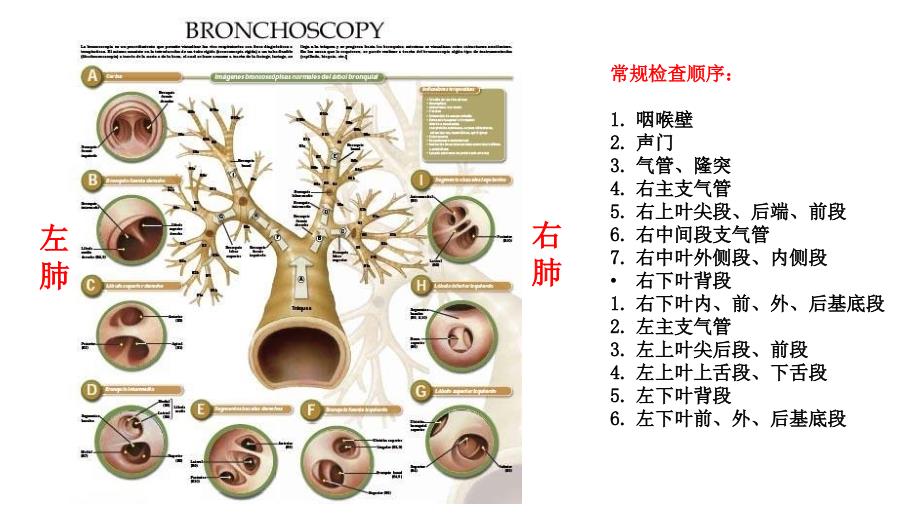支气管分段亚段及及支气管镜检查_第4页
