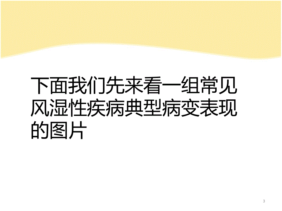 风湿性疾病的影像学表现ppt课件_第3页