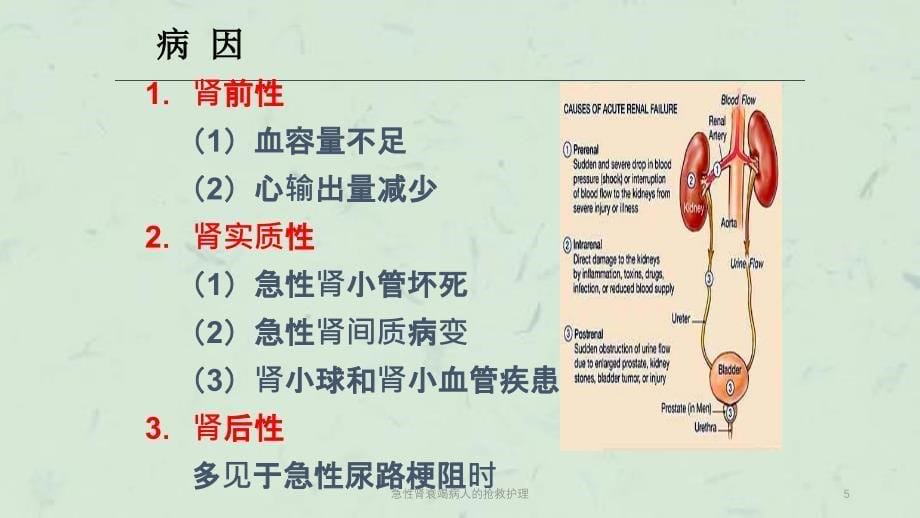 急性肾衰竭病人的抢救护理课件_第5页