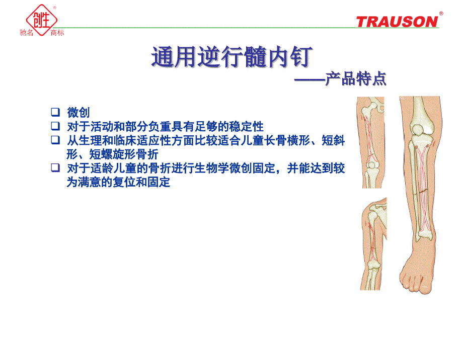 逆行髓内钉—小儿弹性髓内钉课件.ppt_第2页