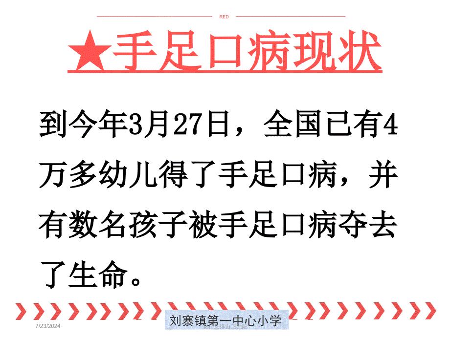 手足口病防幼儿园ppt课件.ppt_第2页