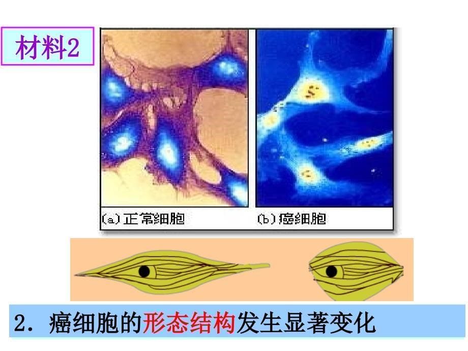 细胞的癌变生物必修一课件.ppt_第5页