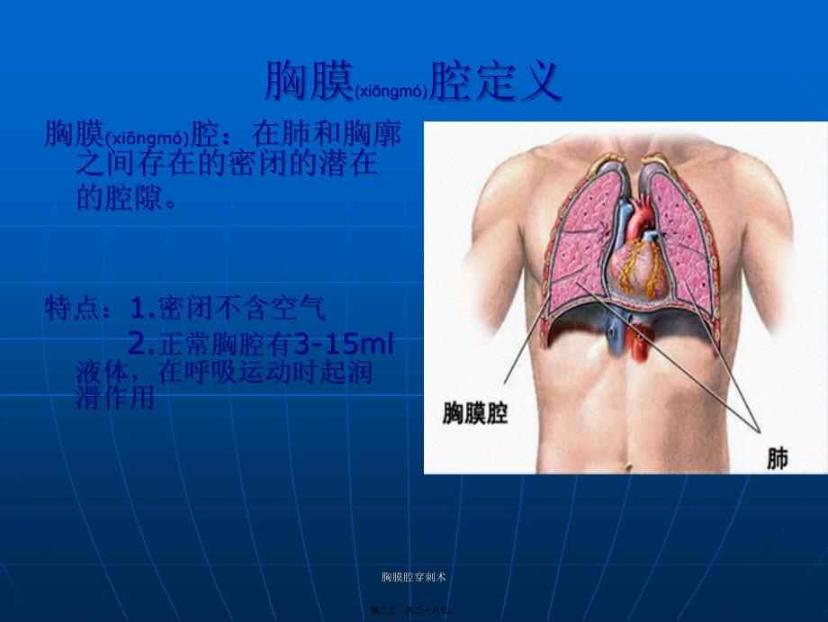 胸膜腔穿刺术课件_第2页