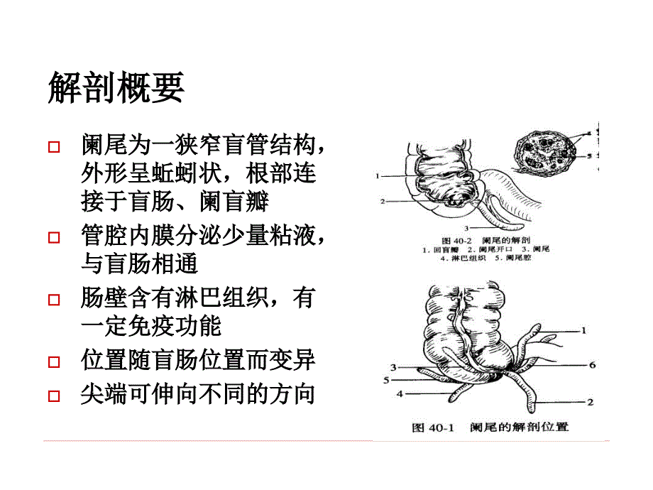 阑尾护理查房_第2页