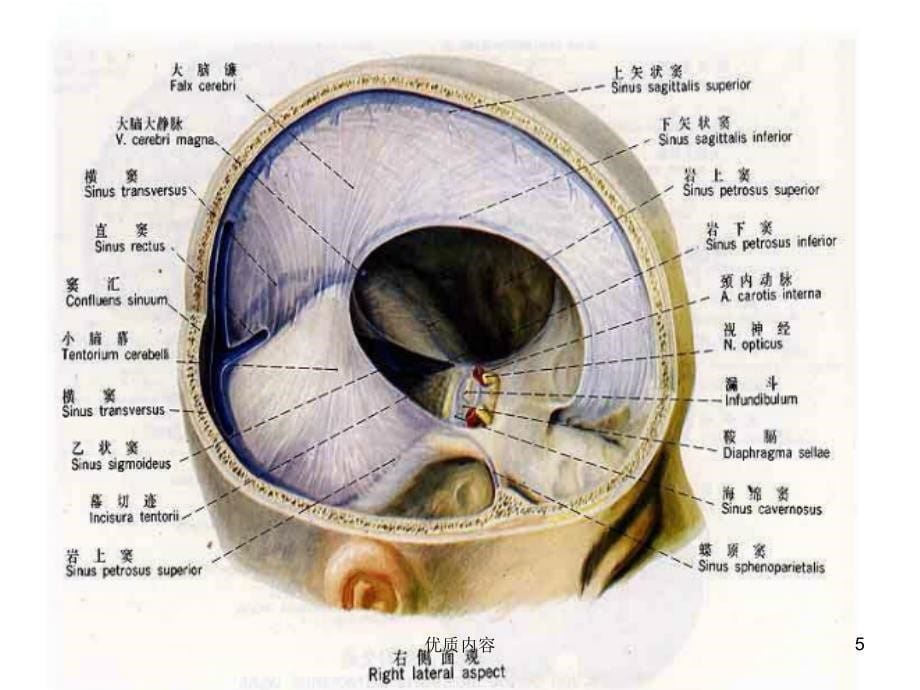 硬膜外及硬膜下血肿参考材料_第5页