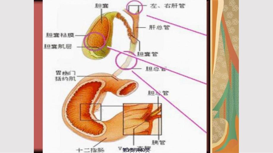 ERCP治疗胆总管结石的护理实用教案_第2页