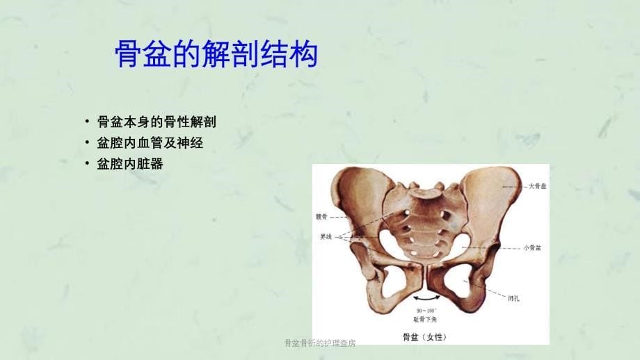 骨盆骨折的护理查房课件_第5页