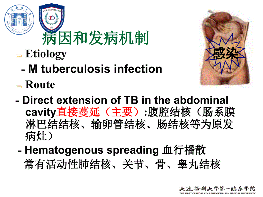 结核性腹膜炎_第4页