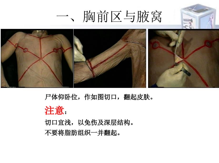 局部解剖学麻醉解剖学操作指导解析课件_第2页