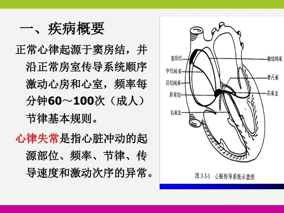 心律失常病人护理ppt_第2页