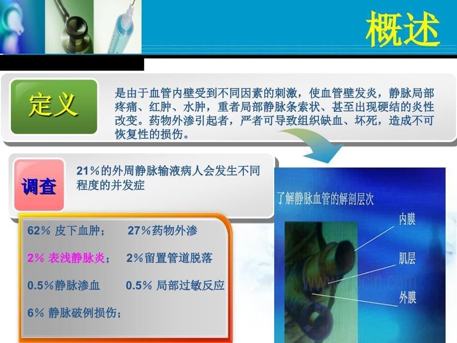 输液并发症静脉炎.ppt_第5页