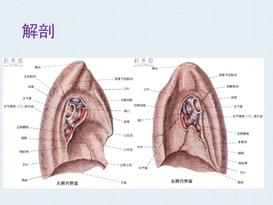 胸腔镜下肺癌根治术_第5页