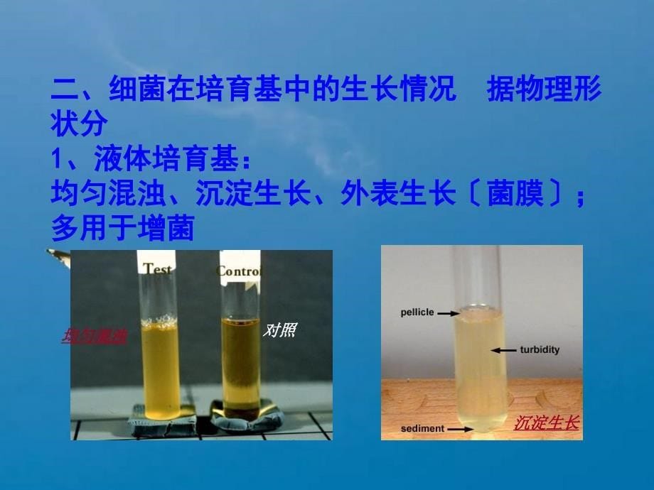 医学微生物学实验三胡ppt课件_第5页