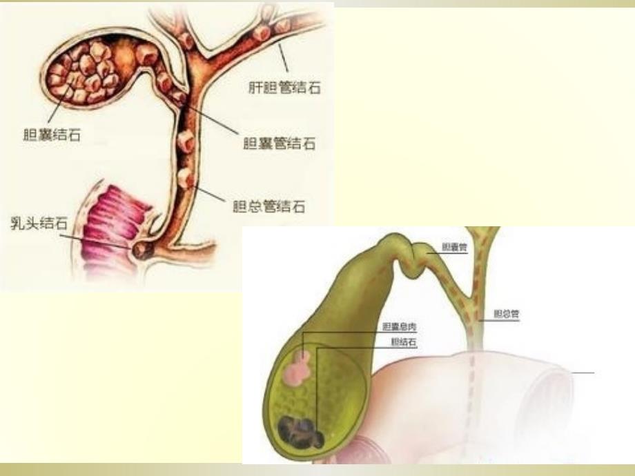 局部解剖学：下腹部、腹膜后隙_第4页