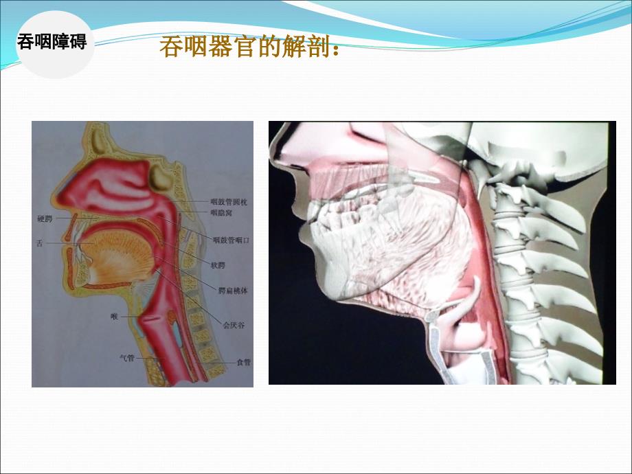 言语及吞咽功能障碍训练.ppt_第4页